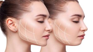 plastic surgery