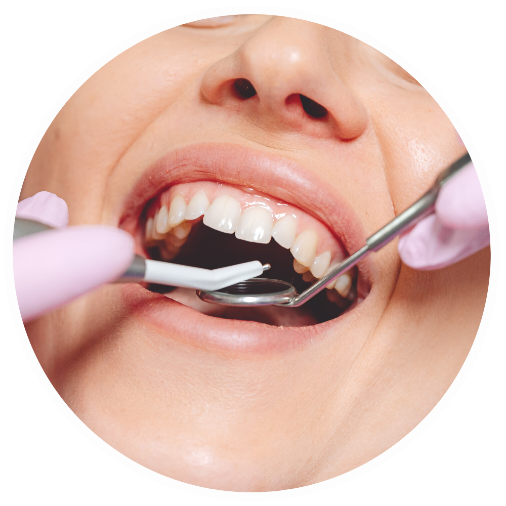 Dental beauty package