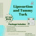 mummies combo liposuction-and-tummy-tuck-english-the-circle-care.jpg