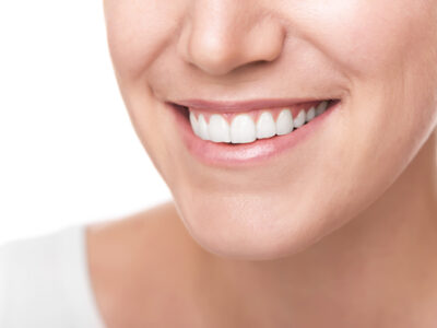 dental-care-package-scaling-polishing-teeth-whitening-Dental-price-averages-in-Egypt-Market- is the-lowest-implants- crowns-veneers-hollywood-smile