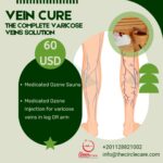 venacure-for-varicose-veins-حقن-الأوزون