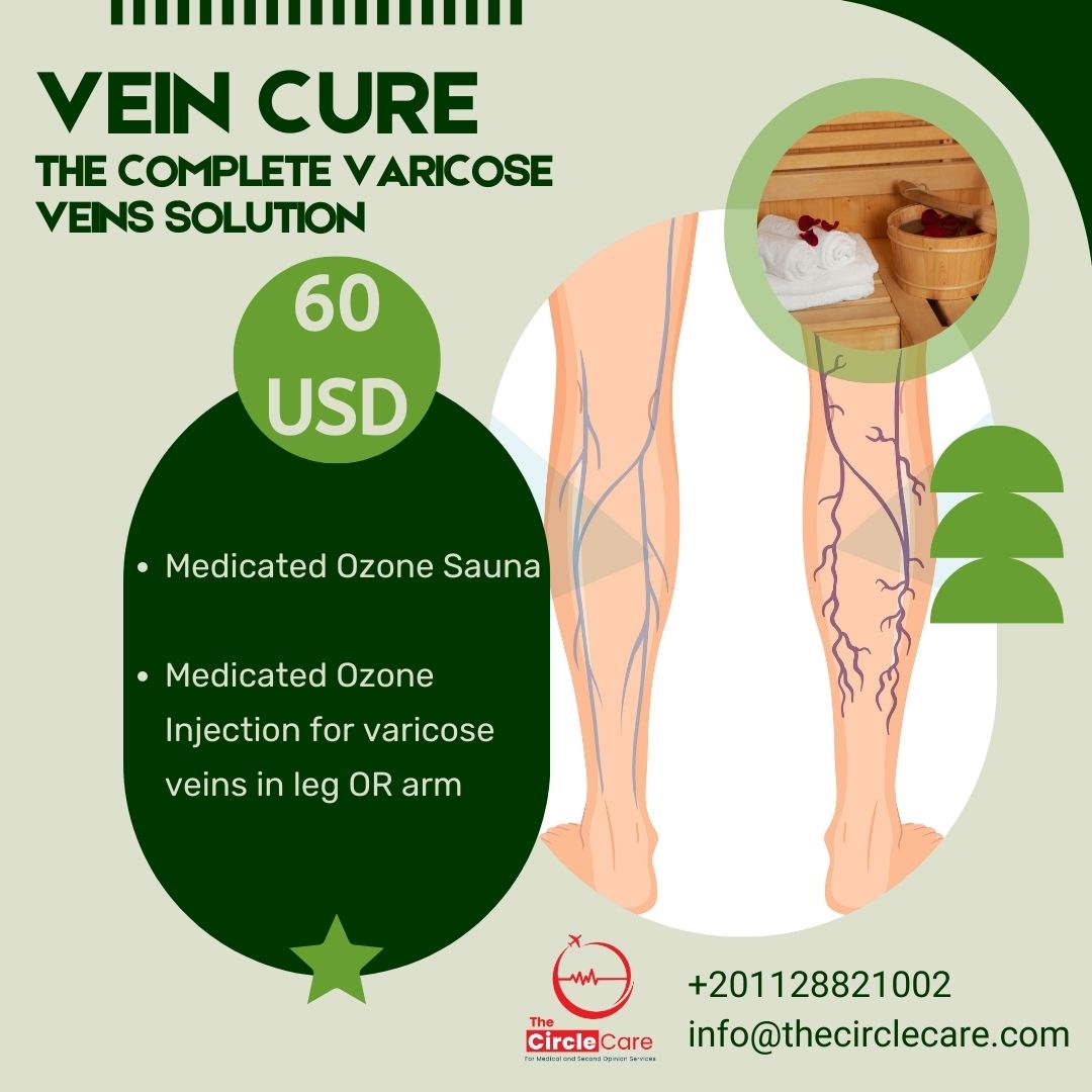 VeIN Cure The Complete Varicose Veins Solution