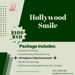 glamourdent10-hollywood-smile-package-10-full-implants-cheapest-price-in-Egypt-and-best-dentists