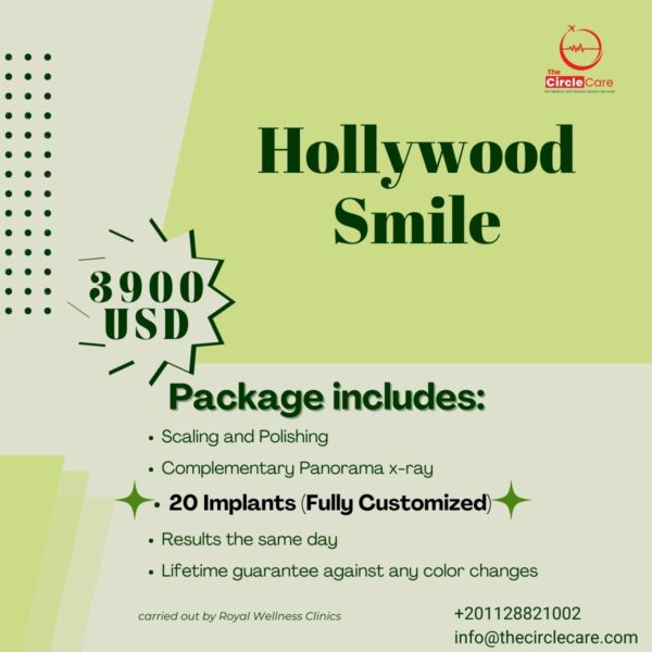 starglam20-hollywood-smile-package-20-full-implants-cheapest-price-in-Egypt