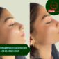 The average price of Rhinoplasty (nose job) in Egypt is $3837, the minimum price is $2500, and the maximum price is $6000. Check the hospital ranking based on requests and 136 reviews to pick the right Rhinoplasty (nose job) clinic for you