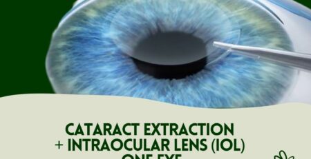 cataract treatment