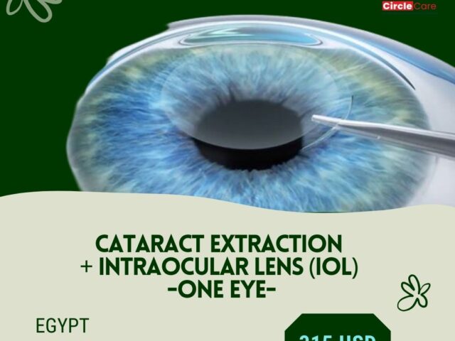 cataract treatment