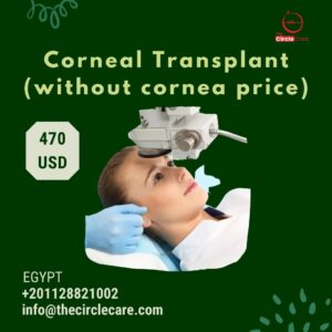 Corneal Transplant (without cornea price) ترقيع قرنية (زرع القرنية بدون سعر القرنية)