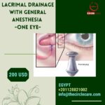 Lacrimal Drainage with General Anesthesia (One Eye) تسليك مجري الدمع بمخدر عام (عين واحده)