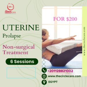non-surgical-treatment-uterine-prolapse-egypt-the-circle-care