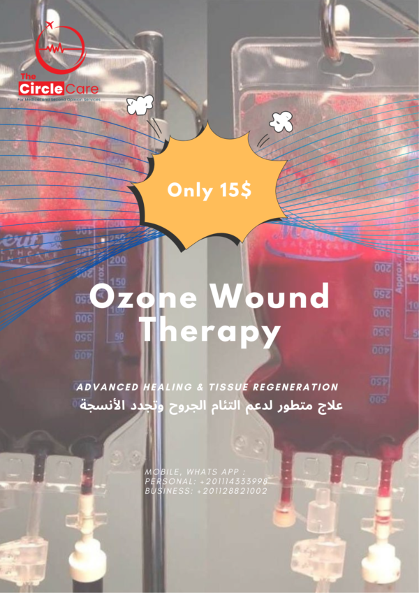 Ozone Wound Therapy (1) Promotional graphic for Ozone Wound Therapy services, featuring a specialized treatment approach for improved healing at 155 USD.
