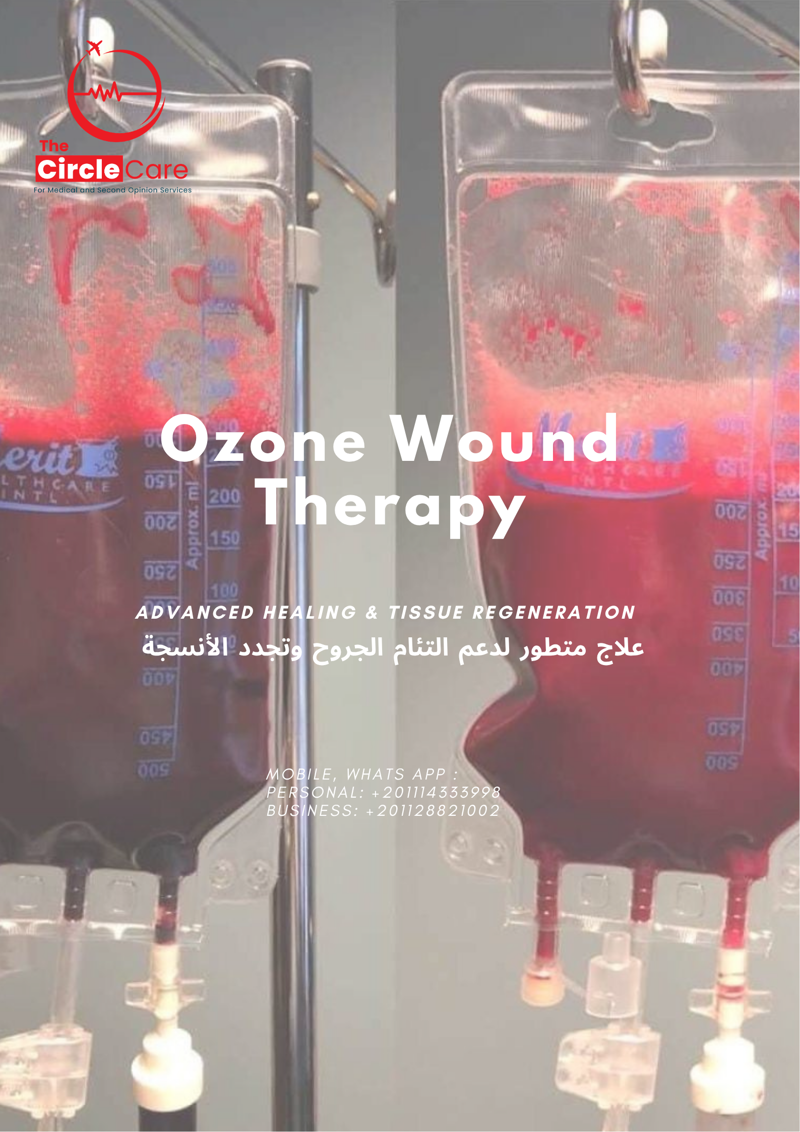 Ozone Wound Therapy