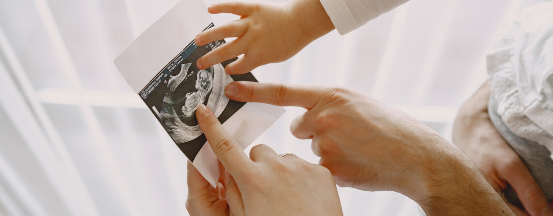 IVF Treatment