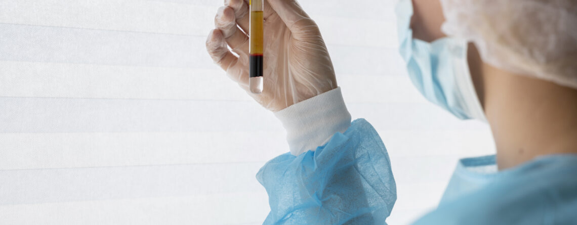 Stem Cell Therapy