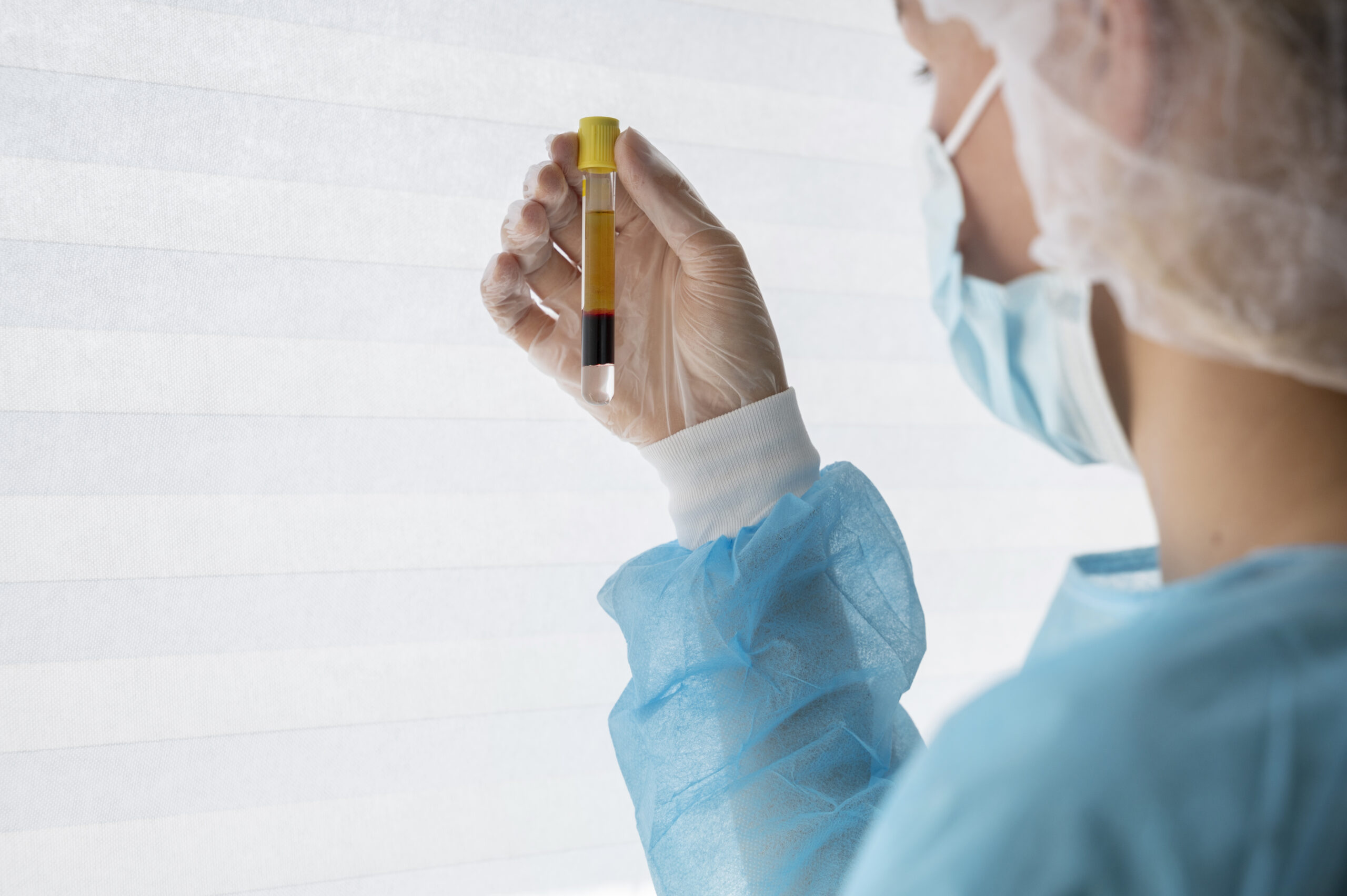 Stem Cell Therapy